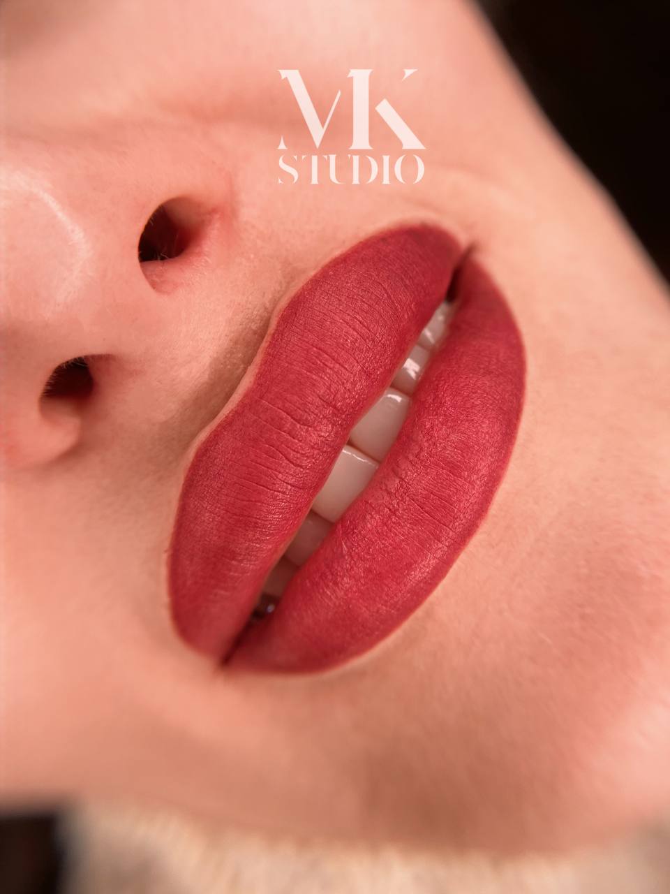 PMU rty, Lipstick Efekt